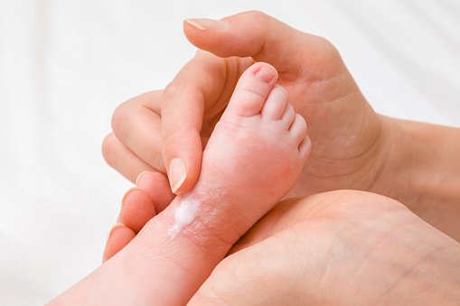Kids dry skin