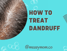 How to Treat Dandruff